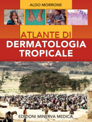 Atlante di dermatologia tropicale