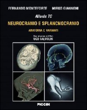 Atlante tc neurocranio e splancnocranio. Anatomia e varianti