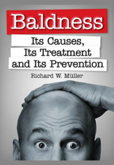 Baldness. Its causes, its treatment and its prevention