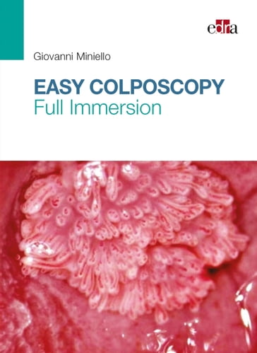 Easy Colposcopy