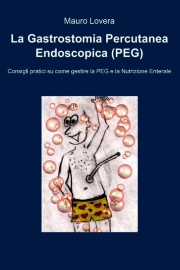 La Gastrostomia Percutanea Endoscopica (PEG)