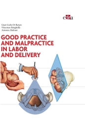 Good practice and malpractice in labor and delivery