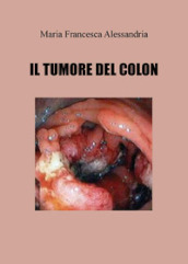 Il tumore del colon