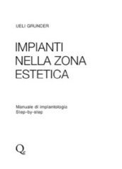 Impianti nella zona estetica. Manuale di implantologia step by step