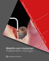 Malattie peri-implantari. Trattamenti chirurgici