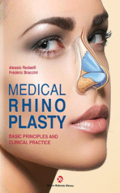 Medical rhinoplasty. Basic principles and clinical practice