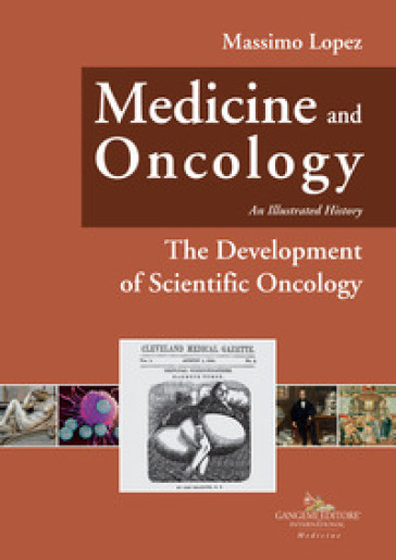 Medicine and oncology. An illustrated history. 6: The Development of Scientific Oncology
