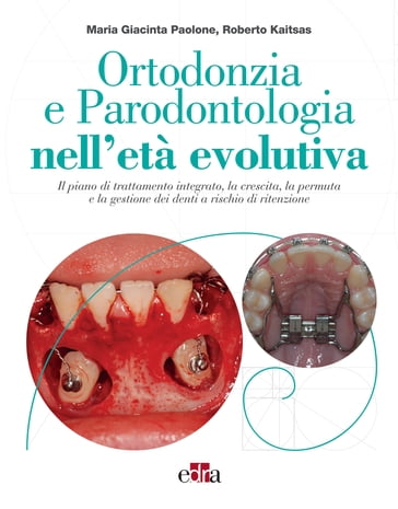 Ortodonzia e Parodontologia nell'età evolutiva