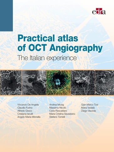 Practical atlas of OCT Angiography